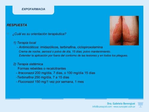 micosis - Dra. Gabriela Berengust - ExpoFarmacia