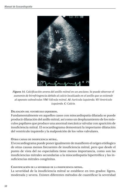 capítulo 3. el ecocardiograma en las valvulopatías - Asociación ...