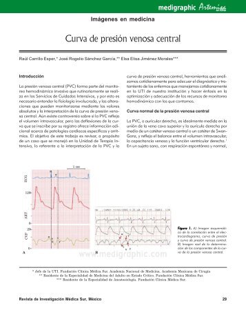 Curva de presión venosa central