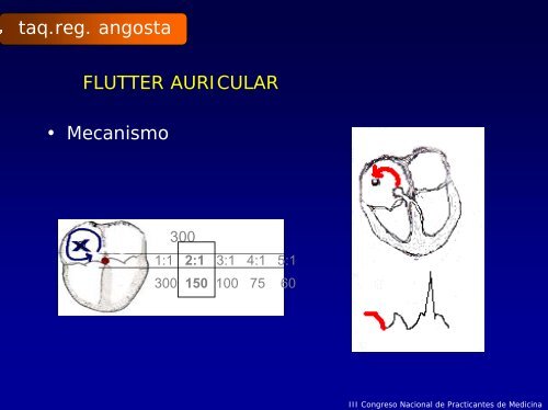 Reconocimiento y Manejo de Las ARRITMIAS CARDÍACAS