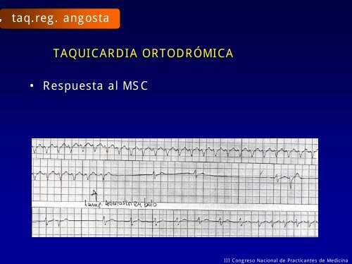 Reconocimiento y Manejo de Las ARRITMIAS CARDÍACAS