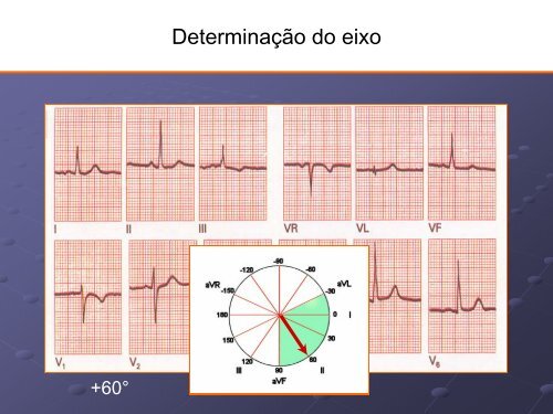 Noções Básicas De Eletrocardiograma - EMV-FMB - Unesp