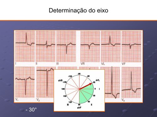 Noções Básicas De Eletrocardiograma - EMV-FMB - Unesp