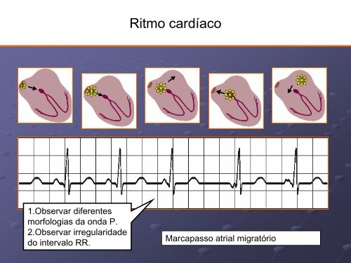 Noções Básicas De Eletrocardiograma - EMV-FMB - Unesp