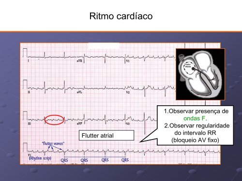 Noções Básicas De Eletrocardiograma - EMV-FMB - Unesp