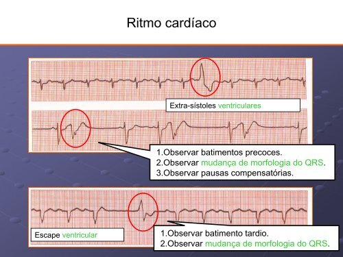 Noções Básicas De Eletrocardiograma - EMV-FMB - Unesp