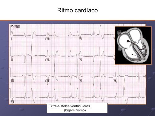 Noções Básicas De Eletrocardiograma - EMV-FMB - Unesp