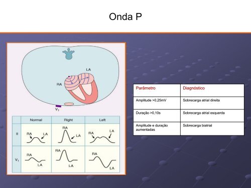 Noções Básicas De Eletrocardiograma - EMV-FMB - Unesp