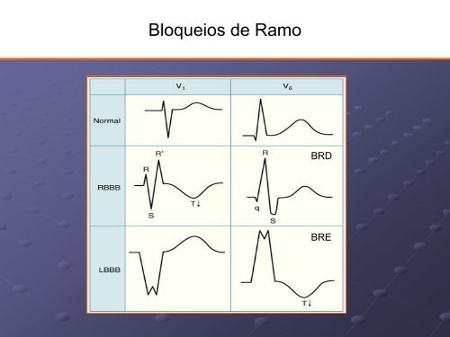 Noções Básicas De Eletrocardiograma - EMV-FMB - Unesp
