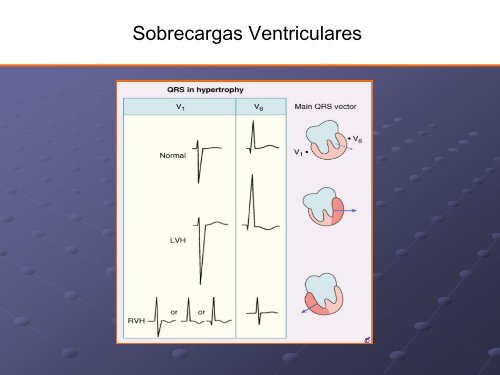 Noções Básicas De Eletrocardiograma - EMV-FMB - Unesp