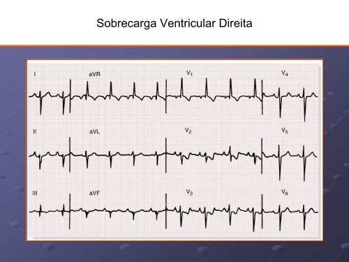 Noções Básicas De Eletrocardiograma - EMV-FMB - Unesp