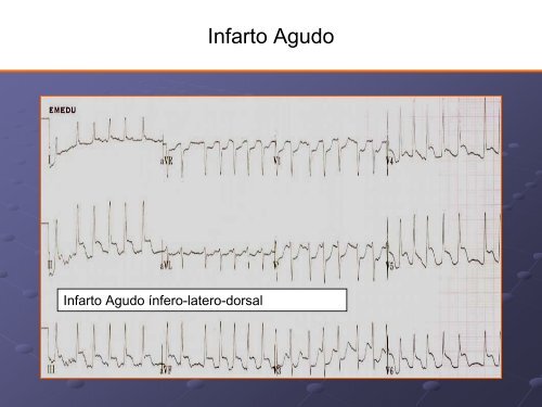 Noções Básicas De Eletrocardiograma - EMV-FMB - Unesp