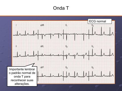 Noções Básicas De Eletrocardiograma - EMV-FMB - Unesp