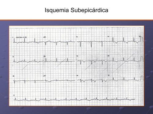 Noções Básicas De Eletrocardiograma - EMV-FMB - Unesp