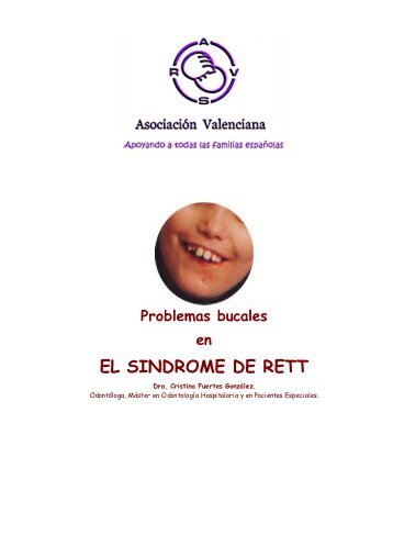 Problemas bucales - Asociación Española del Síndrome de Rett