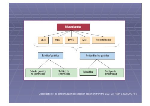 Displasia Arritmogénica del Ventrículo Derecho.