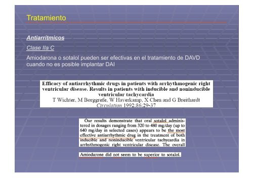 Displasia Arritmogénica del Ventrículo Derecho.