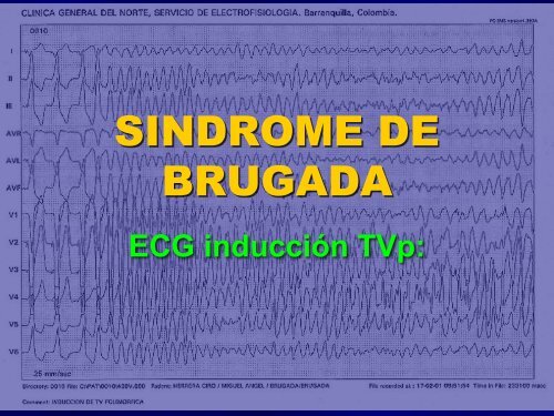 arritmias en urgencias - sociedad latinoamericana de estimulación ...