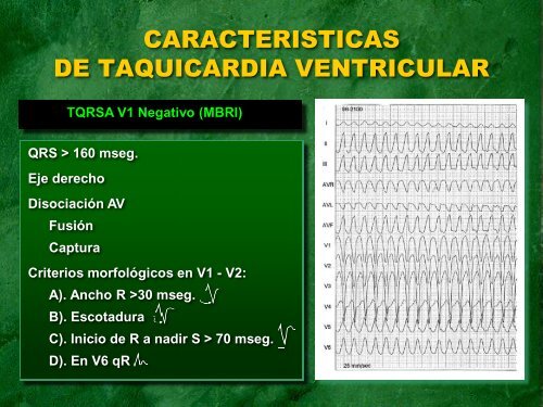 arritmias en urgencias - sociedad latinoamericana de estimulación ...