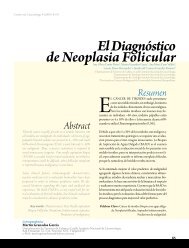 El Diagnóstico de Neoplasia Folicular - Instituto Nacional de ...