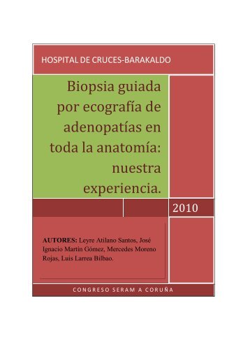 Biopsia guiada por ecografía de adenopatías en toda la anatomía ...