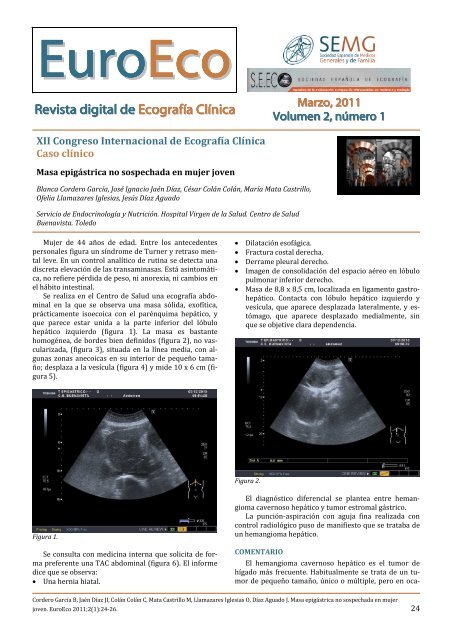 Revista digital de Ecografía Clínica - Revista Euroeco
