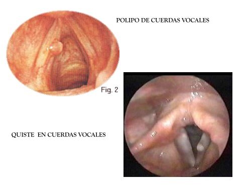 El Estudio de la Técnica Vocal