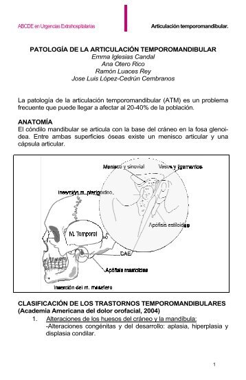 13.6. Patología de la articulación temporomandibular - ABCDE en ...