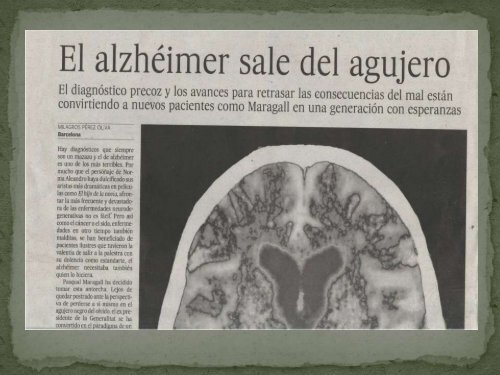 ALZHEIMER 10 MANDAMIENTOS