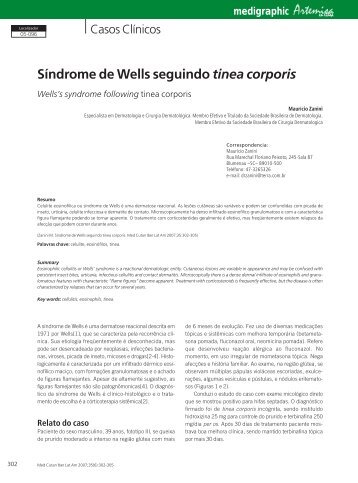 Síndrome de Wells seguindo tinea corporis - edigraphic.com