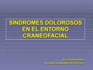 Síndrome del clivus - Dolor Irruptivo.com