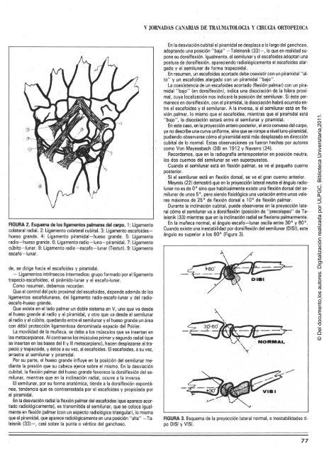 Inestabilidades del carpo - Acceda