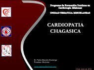 cardiopatia chagasica - Fac