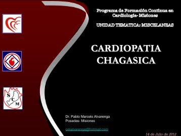 cardiopatia chagasica - Fac