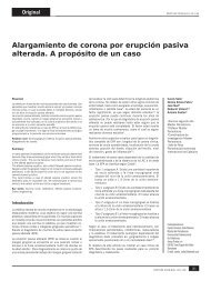 Alargamiento de corona por erupción pasiva ... - Nexus Médica