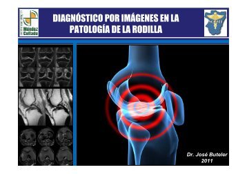 DIAGNÓSTICO POR IMÁGENES EN LA PATOLOGÍA DE ... - SCEMT