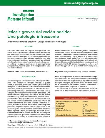 Ictiosis graves del recién nacido: Una patología ... - edigraphic.com