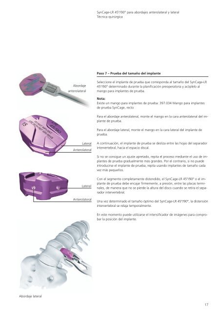 SynCage-LR 45°/90° para abordajes anterolateral y lateral - Synthes