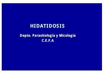 HIDATIDOSIS