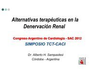 Alternativas Terapéuticas para la Denervación Renal - CACI