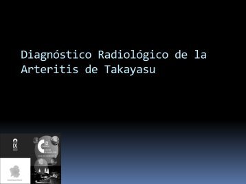 Diagnóstico Radiológico de la Arteritis de Takayasu
