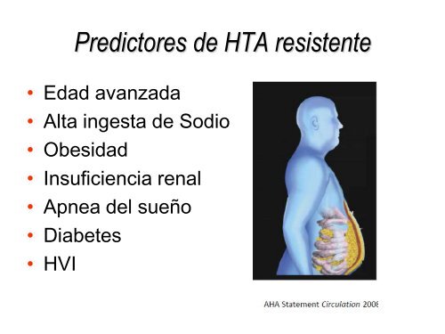 Ablación por radiofrecuencia de arteria renal en la - CACI