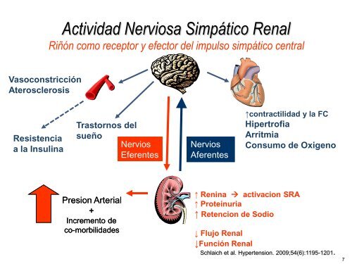 Ablación por radiofrecuencia de arteria renal en la - CACI