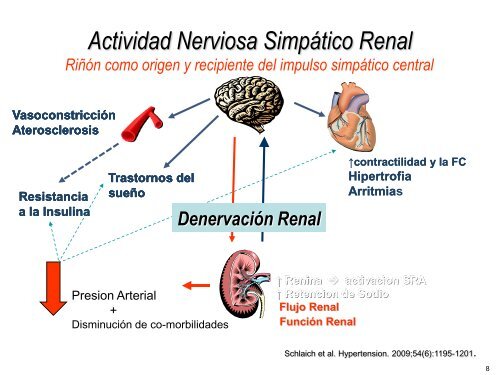 Ablación por radiofrecuencia de arteria renal en la - CACI