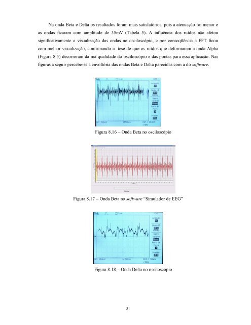 SIMULADOR DE EEG.pdf