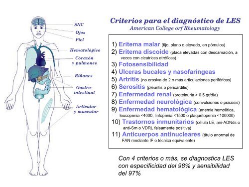 Enfermedad Actual