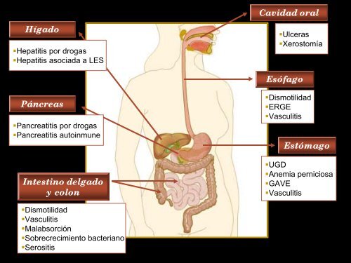 Enfermedad Actual