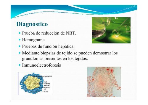 Inmunodeficiencias