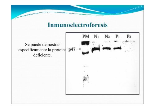 Inmunodeficiencias