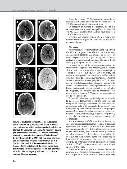 miolo final 1 - Revista Panamericana de Infectología